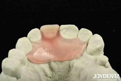 Cina Personalizzazione Flessibile Denture Finish utilizzando la tecnologia di disposizione dei denti con buona elasticità in vendita