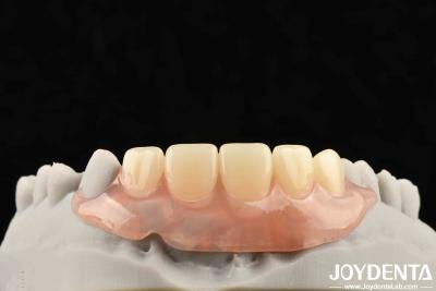 Cina Elaborare un quadro tecnologico per la creazione di finiture dentali per una struttura orale stabile nella tecnologia dentale in vendita