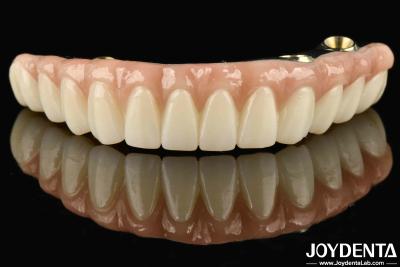 Cina Ponte ibrida di zirconia in Ti-Bar compatibile con denti e gengive naturali Autobiografia ripristinare la funzione masticatrice in vendita