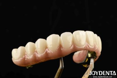 Cina Ponte ibrida di zirconia in ti-bar resistente, realizzata con materiali di titanio e zirconia per il lavoro pesante in vendita