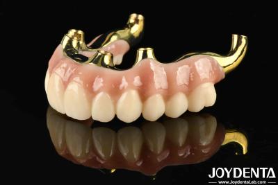 Cina Ripristino della funzione masticatrice Ponte ibrida in zirconia a ti-bar con elevata biocompatibilità e adattamento preciso in vendita