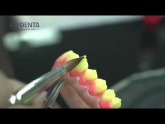 Anterior Tooth Indication Dental Veneers With 0.5mm Thickness And Perfect Permeability