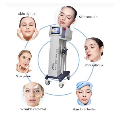 China Professional Radio Frequency Microneedle RF Machine Skin Rejuvenation Skin Care Partial Face Lifting for sale