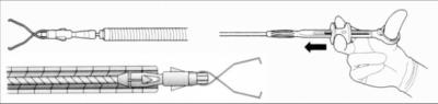 Chine Agrafes de GM Grey Flexible Rotatable Surgical Titanium 11mm à vendre