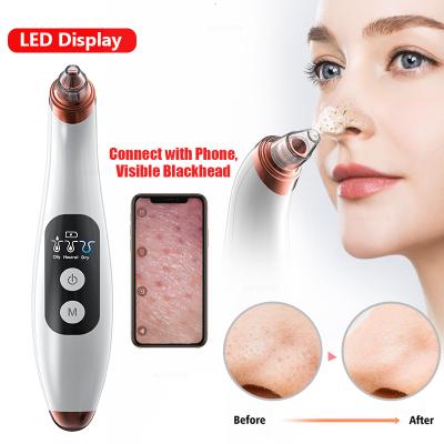 China Blackhead Removal Electric Strong Suction 5 Facial Heads Peep Tool Kit Acne Vacuum Blackhead Remover Blackhead Remover With Camera for sale