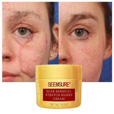 China Anti Wrinkle Retinol Face Cream Firming Anti Aging Lifting Remove Wrinkle Whitening Moisturizing Illumination Facial Skin Care for sale