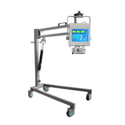 China Popular Human Use Product 100mA Portable X Ray Machine For Human for sale