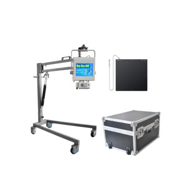 China Popular Human Use Product 100mA Portable Digital X-ray Machine For Human for sale