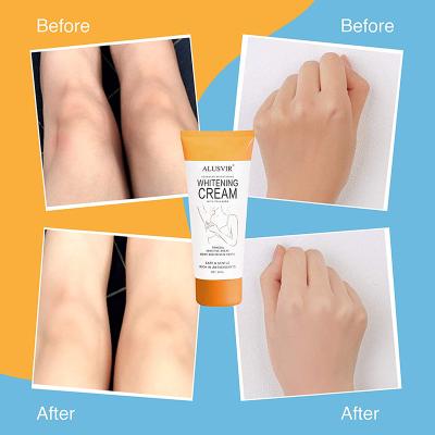 China Weight Loss Remove Armpit Black Patches Peel Light Up Natural Fast Effective Armpit Whitening Under Cream Lotion For Black People for sale