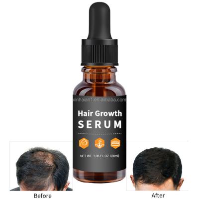 China Customization Hair Growth Treatment Serum for Black Women Private Label for sale