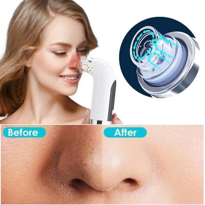 China Small Professional Bubble Clean Electric Blackhead Pore Remover Facial Cleansing Remover for sale