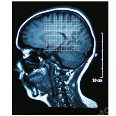 China Wood Pulp Detectable Focal X-Ray Localization System for sale