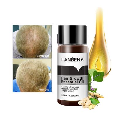 China 100% Natural Organic Hair Loss Prevention Hair Growth Oil Serum Hair Growth Oil for Men and Women Hair Growth for sale