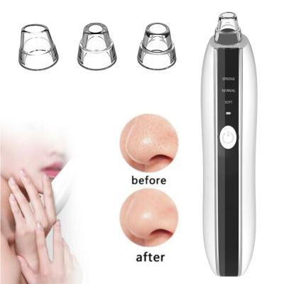 China Black Head Visual Electric Acne Face Pore Nose Heating Camera Deep Cleansing Remover Blackhead Remover for sale