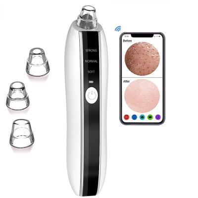 China Black Head Removal Beauty Equipment Skin Whitening Tool Kit Face Cleaner Blackhead Remover for sale