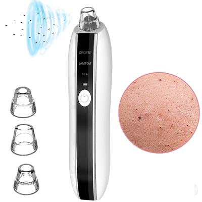 China 2021 Black Head Removal Camera Home Remove Whitehead Extraction Remover Vacuum 3 Suction Blackhead Removal for sale