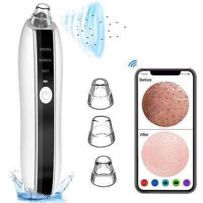 China Best Cordless Black Head Vacuum Extractor Removal Pore Machine Remove Acne Suction Blackhead Remover for sale