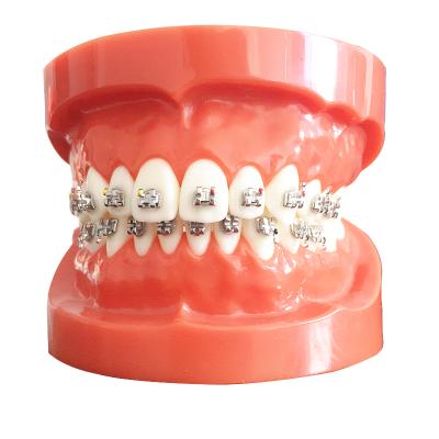 China MIM High Quality Orthodontic Metal Roth/MBT Bondable Dental Brackets Comfortable Dental Orthodontic Materials for sale