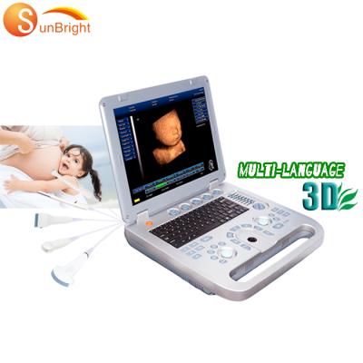 China Cheapest Mini OB Ultrasound Machine 3D Laptop Baby Ultrasound Scanner Portable Machine for sale