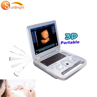 China OB Sun 800d Full Ultrasound Notebook B/W Ultrasound Machine LED Laptop Digital Ultrasound Scanner for sale