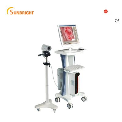 China Metal colposcope for gynecology Sony Camera SUN-200L/china fully digital digital colposcope for sale