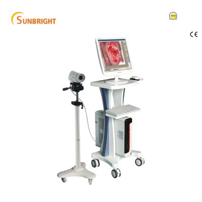 China Good Quality Electronic Metal Colposcope Video Imaging System For Gynecology With High Pixel Camera for sale