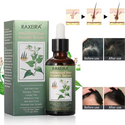 China Natural and Organic Private Label Anti Hair Loss and Hair Growth Treatment Regrowth Hair Loss Prevention Serum for sale