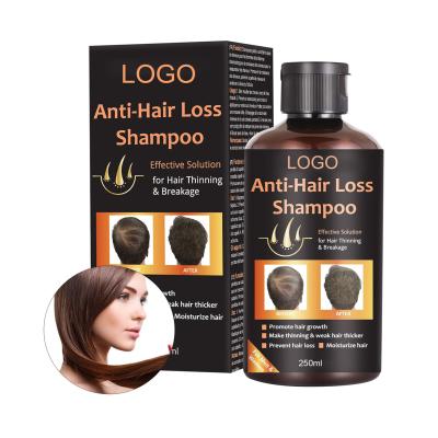 China Organic Hair Loss Prevention Private Label Hair Shampoo Anti Hair Loss Shampoo Hair Growth Shampoo for sale