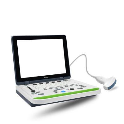 China Hospital Portable Ultrasound System Ultrasound Medical Device Laptop 3D 4D Veterinary Obstetrics Apogee 2300V for sale