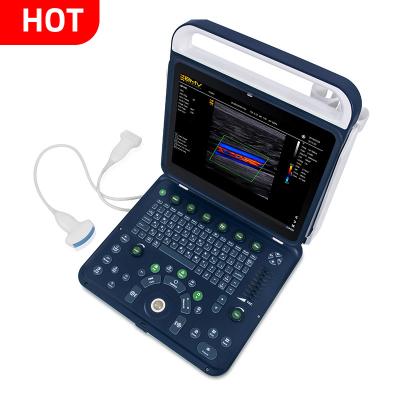 China Portable Color Doppler Ultrasound Scanner System Applicable To Body Scanning Hospital Use Portable Ultrasound Imaging System BPU60 for sale