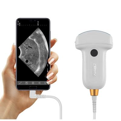 China Portable Metal Pocket Ultrasound Scanner for Pets USB Ultrasound Scanner for Small and Large Animal Scanning for sale