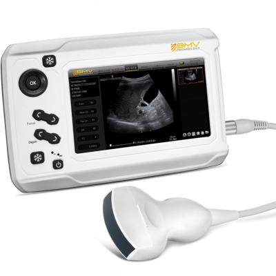 China Ultrasonic Pregnancy Test Ultrasound Machie MX300 for sale