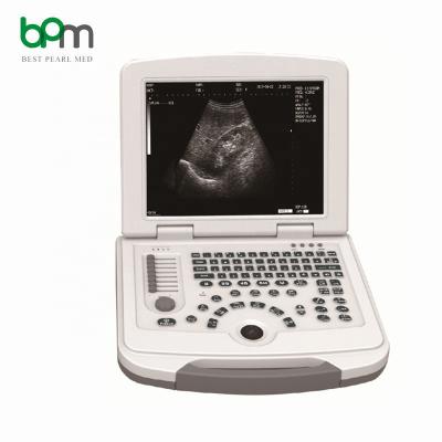 China BPM-BU2 BW Portable Laptop Doppler Ultrasound Cardiac Machine BPM-BU2 for sale