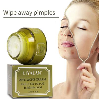 China Factory Best Selling Private Label Acne Treatment Acne Face Cream Natural Organic Acne Scar Removal Tea Tree Oil Treatment Anti Acne Face Cream For Facial Massage for sale