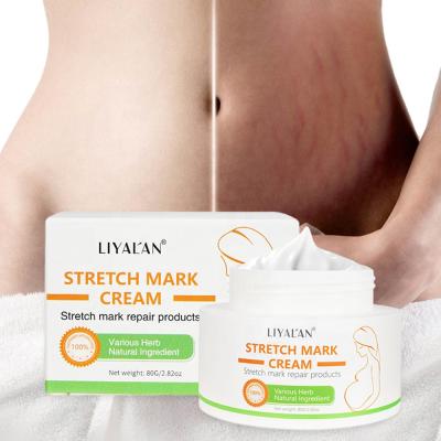 China Pure Natural Organic Nourishing Stretch Mark Cream Best Body Skin Care Stretchmark Cream Scar Repair Pregnancy Abdomen Stretch Mark Cream for sale