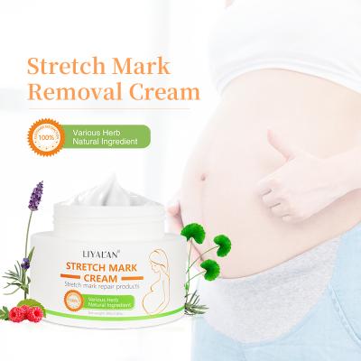 China Nourishing Natural Organic Skin Care Scar Repair Stretch Mark Abdomen Body Stretch Mark Removal Cream for sale