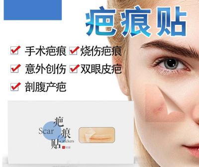 China Medical Grade Scar away Silicone Gel Scar Treatment, ScarAway Skincare Long Silicone Scar Sheets for Hypertrophic Scars for sale