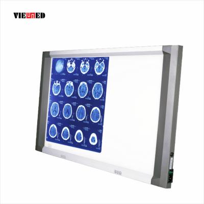 China Independent Dimming Independent Dimming Led X-ray Film Viewer Double Negatoscope Screen for sale