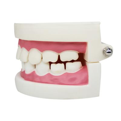 China Teaching Aids/Doctor-patient Communication/Dental PVC Tooth Model Dental Model Oral Teeth Hygiene Model Display Dental Care for sale