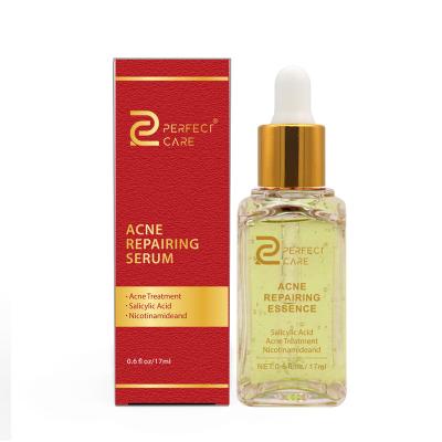 China Professional Type Acne Treatment Anti Acne Moisturizer Care Perfect Brand Balance Water Oil Skin Serum for sale