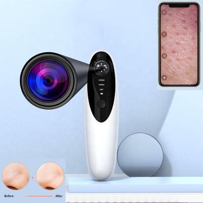 China Black Head Portable Black Head HD Rechargeable Portable Blackhead Remover HD Eye Pore Remover Vacuum Head Vacuum Removal 5 Suction Head Electric Visual Blackhead Remover for sale