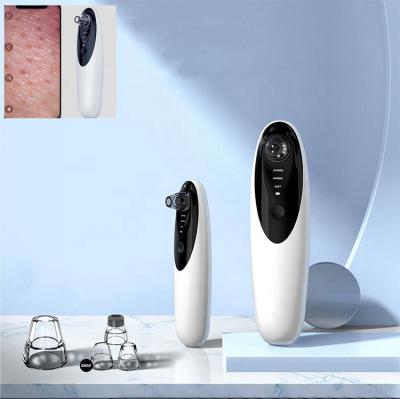 China Black Head Portable Rechargeable Mini USB Face Beauty Radio Pore Nose Remover Electric Blackhead Removal Vacuum Blackhead Remover for sale