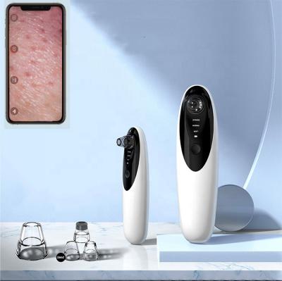 China Black Head Portable Electric Facial Pore Remover Vacuum Blackhead Remover Visual Blackhead Removal Tool for sale