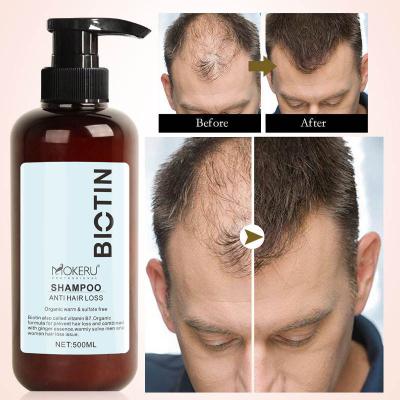 China MOKERU Good Return Hair Loss Prevention Anti Hair Loss Set Shampoo and Essential Oil Set Wholesale Hair Loss Treatment for sale