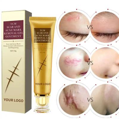 China Whitening Skin Revitalizer Custom Acne No Scar Removal Cream Private Label Treatment Face Damage Skin Repair Cream for sale