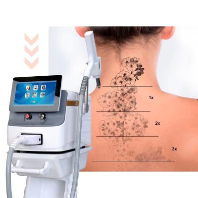 Cina Commerciale OPT 585nm Picosecond Laser Machine Tattoo Rimozione Beauty Machine in vendita