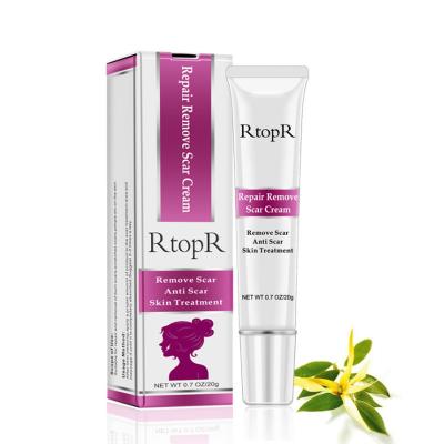 China Skin Revitalizer RtopR Repair Remove Scar Cream Remove Scar Anti Scar Skin Treatment for sale