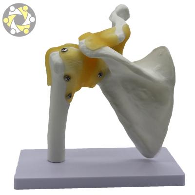 China Education Teaching Shoulder Joint Anatomical Model for Medical School Display Model for Classroom for sale