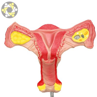 China Education Genital Organs Female Internal Uterus Anatomical Model for sale