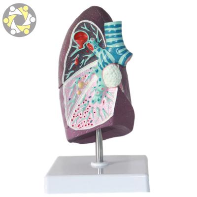 China Education Lung Anatomy Artificial Lung Medical Teaching Plastic Model for sale